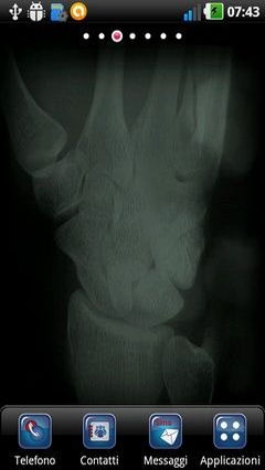 X-ray Body