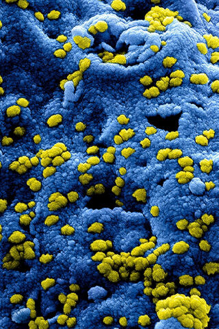 The Invisible Invader: A Close-Up of COVID-19