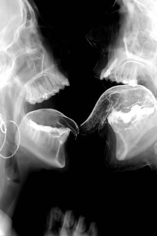 Love in the Shadows: The Kissing X-Ray 💞