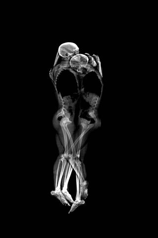 Eternal Embrace: Love Beyond the Surface