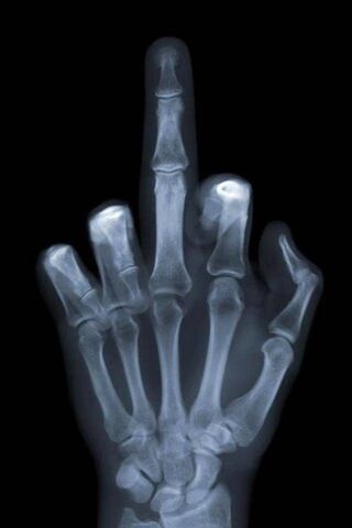 الأشعة السينية الاصبع