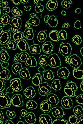 Smudges of Nature: A Colorful Microcosm 🌿✨