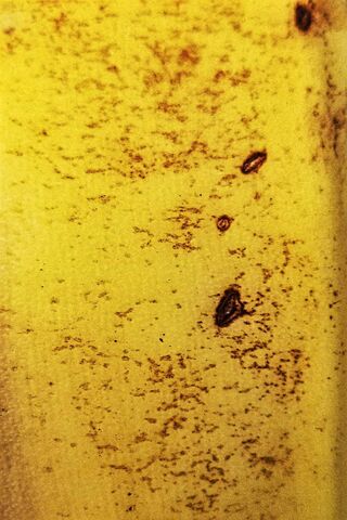 The Slippery Truth: A Closer Look at Banana Peel 🍌