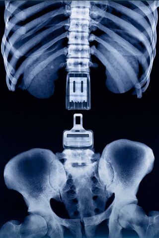 The Hidden Truth: A Skeletal Revelation 🦴🔍