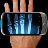 X-Ray Scannerv1.1.12