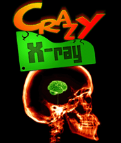 Crazy X-ray