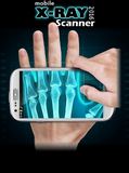 Mobile X-Ray Scanner 2016