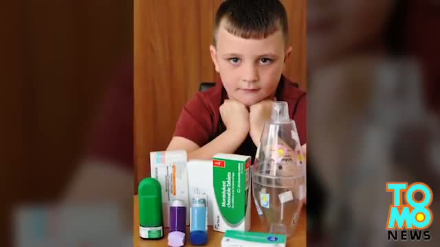 Extreme allergies boy allergic to own hair gets asthma attacks from strong emotions