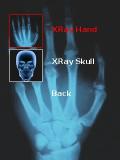 X Rays Escaner