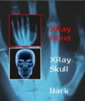 X RAY SCANNER